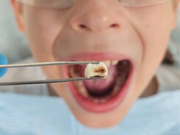 Best Emergency Dental Surgery in Thompsonville, PA